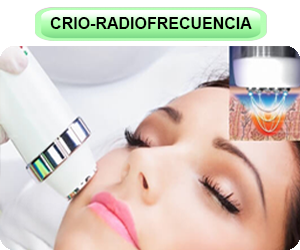servicios_faciales_CRIOradiofrecuencia_02